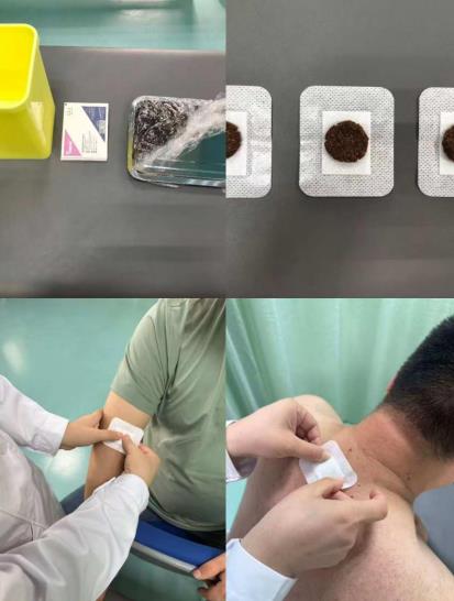 中国科大附一院三伏贴“开贴”。